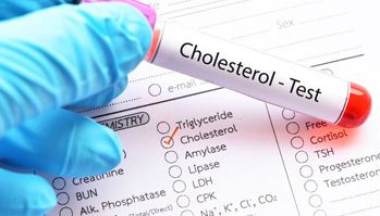 Análisis de Colesterol 